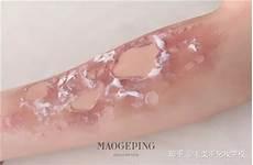 画伤口教程简单 吓人